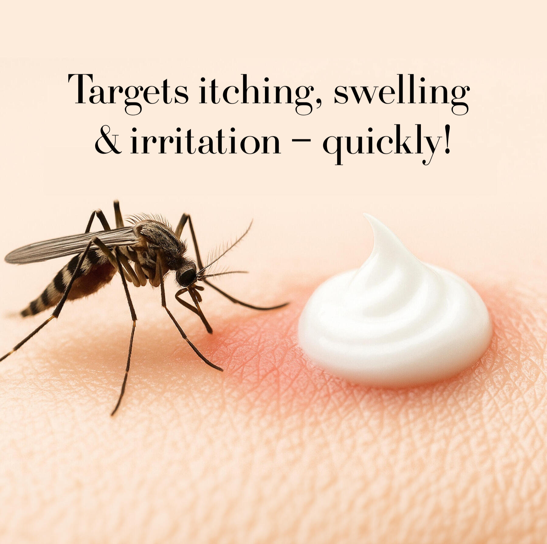 Bug bite relief cream for outdoor activities and travel